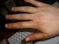 Hands a few hours post-Mystic Tan